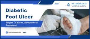 Diabetic Foot Ulcer Stages, Causes, Symptoms & Treatment